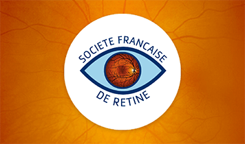 Société Française de Rétine